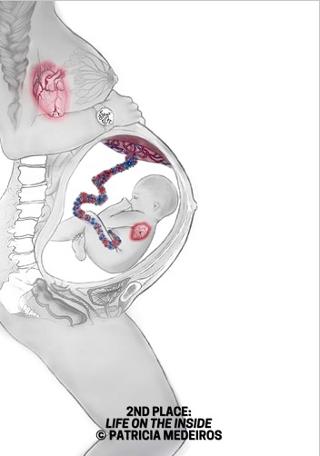 A diagram of a baby in a pregnant person's stomach Description automatically generated