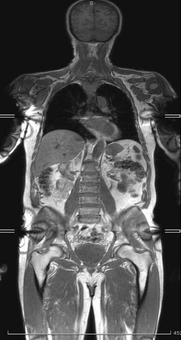 An x-ray of a person's body Description automatically generated