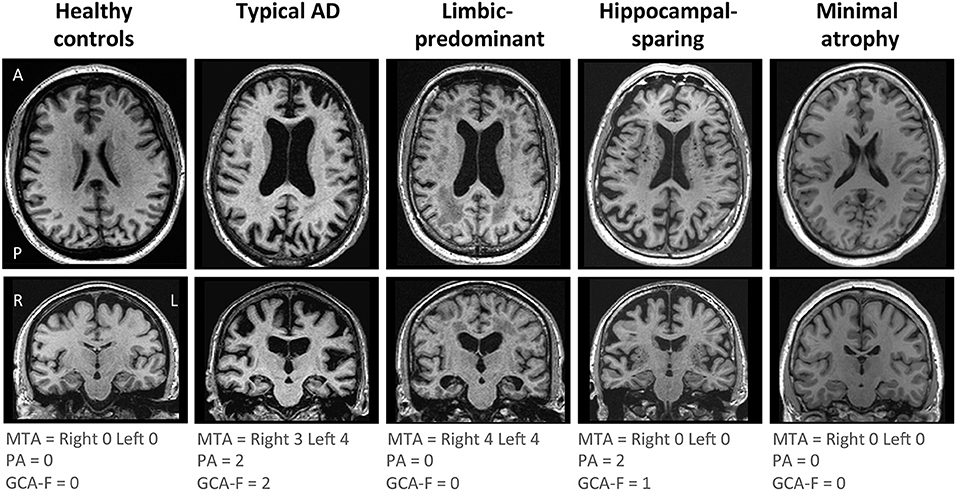 A collage of images of a brain Description automatically generated